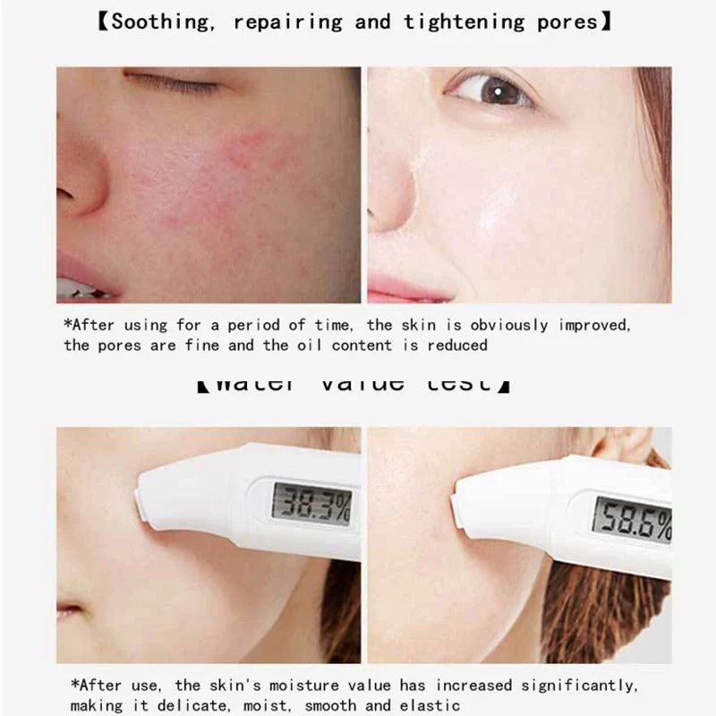 Centella Glow Sleep Masks