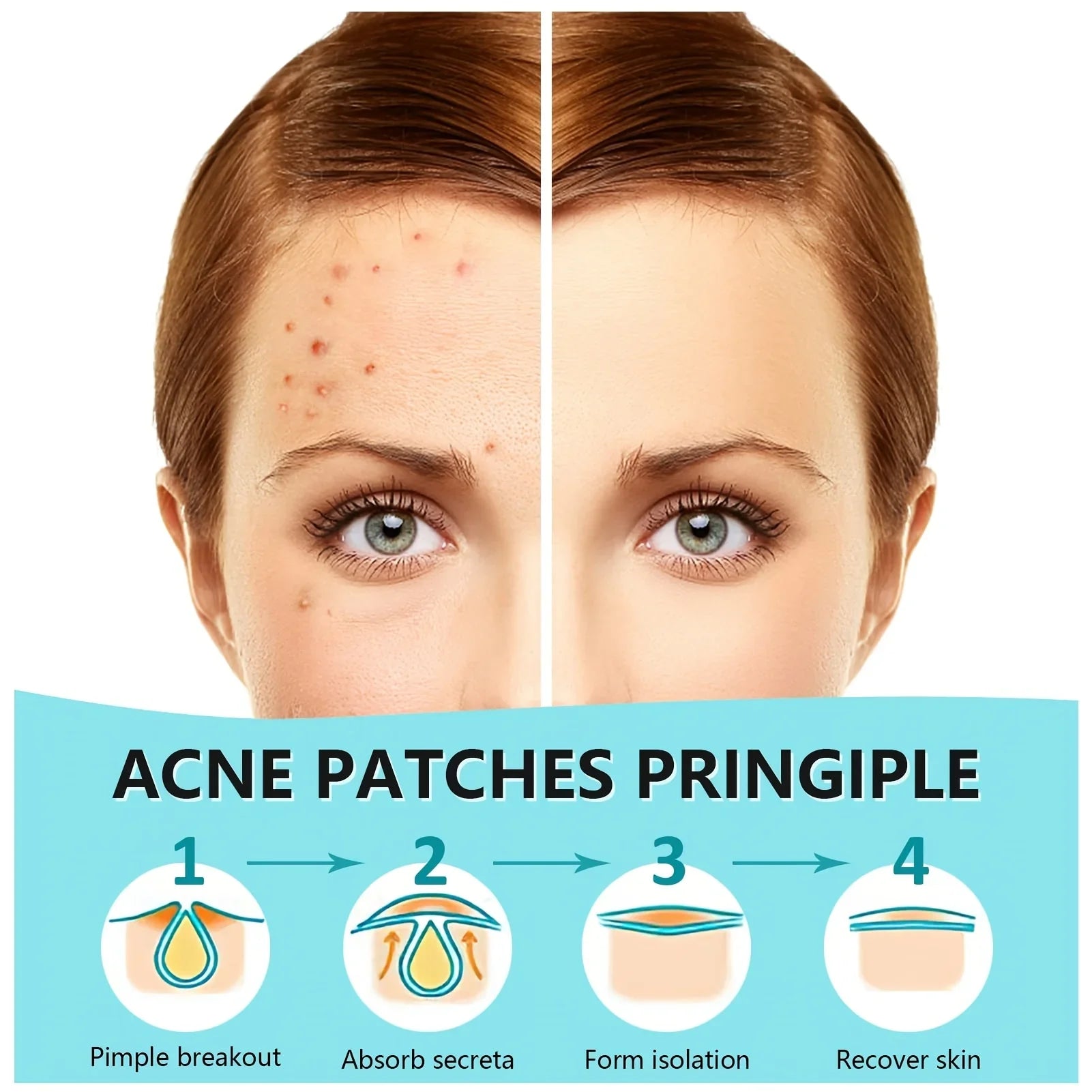 Clear Skin Magic Pimple Patches